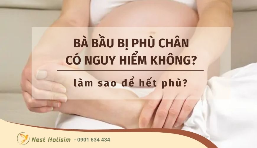 Bà bầu bị phù chân có bị nguy hiểm không? Làm sao để hết phù?