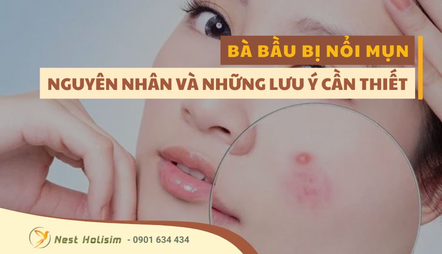 BÀ BẦU BỊ NỔI MỤN: NGUYÊN NHÂN VÀ NHỮNG LƯU Ý CẦN THIẾT