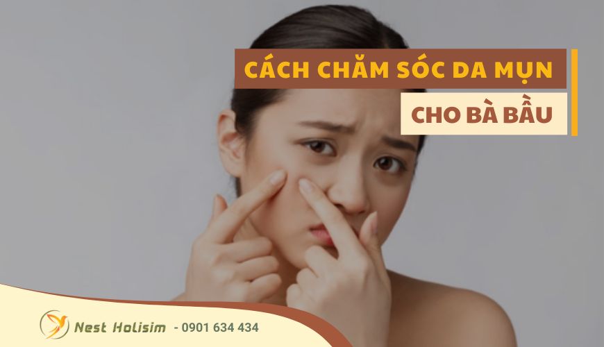 CÁCH CHĂM SÓC DA MỤN CHO BÀ BẦU