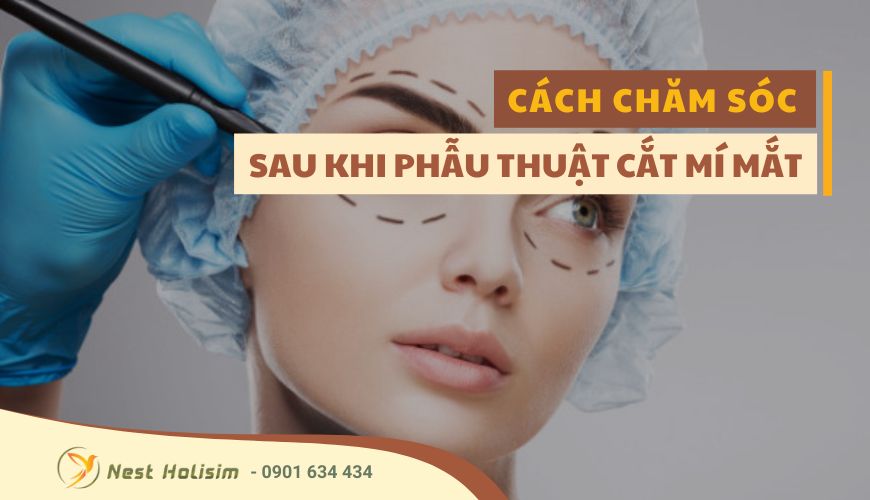 CÁCH CHĂM SÓC SAU KHI PHẪU THUẬT CẮT MÍ MẮT