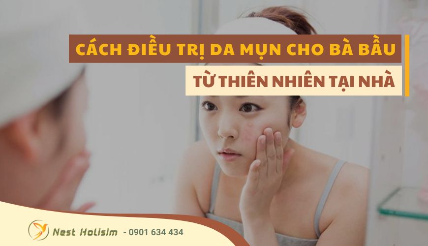 CÁCH ĐIỀU TRỊ DA MỤN CHO BÀ BẦU TỪ THIÊN NHIÊN TẠI NHÀ