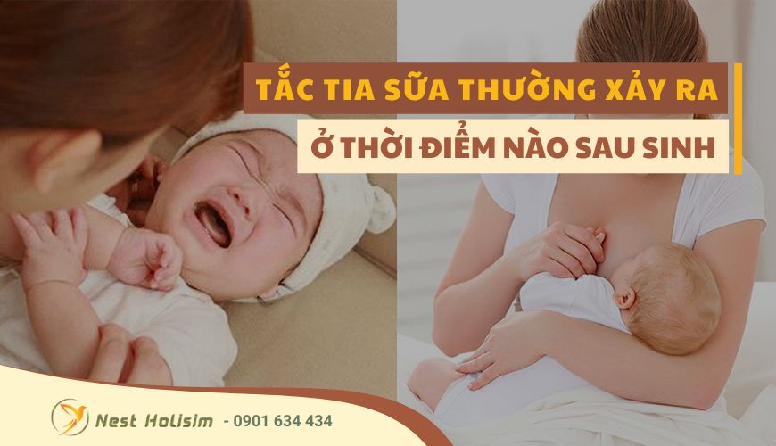 TẮC TIA SỮA THƯỜNG XẢY RA Ở THỜI ĐIỂM NÀO SAU SINH